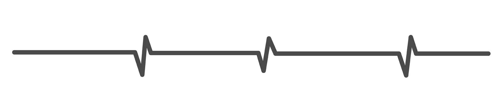 Đường zigzag mỏng, liên tục